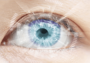 chirurgie réfractive